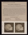 Cranio-Cerebral Topography - no. 5